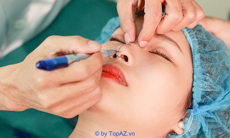 Chi phí nâng mũi phụ thuộc vào các yếu tố nào?