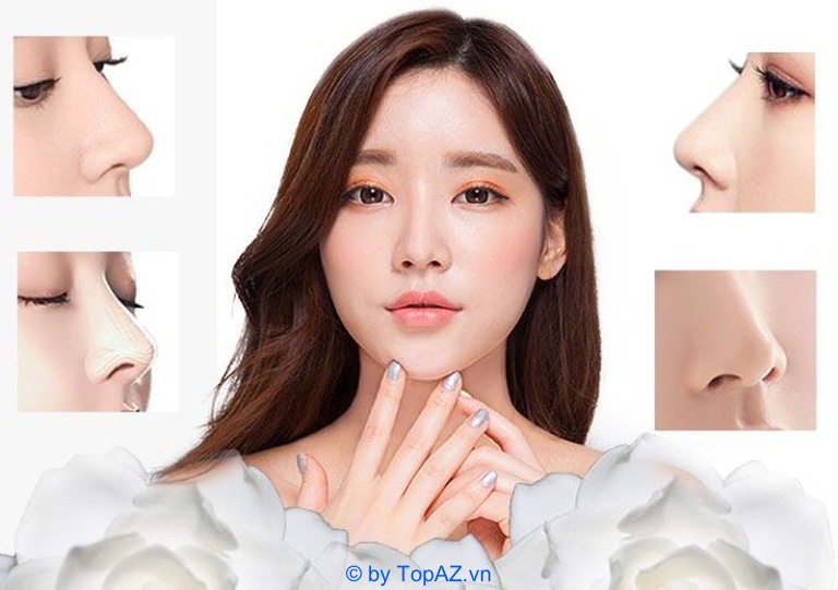 Nâng mũi cấu trúc