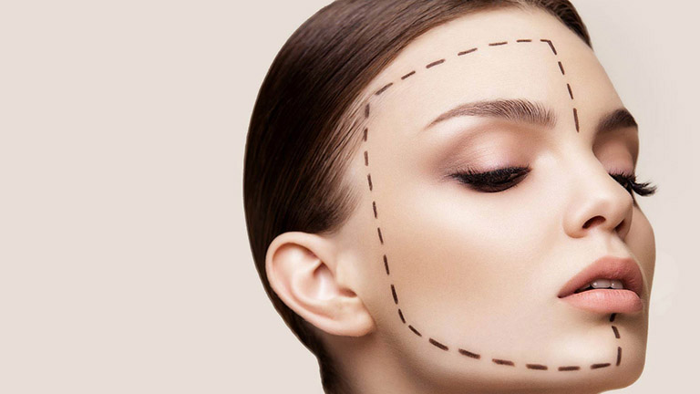Ưu điểm và hạn chế đối với phương pháp nâng mũi cấu trúc