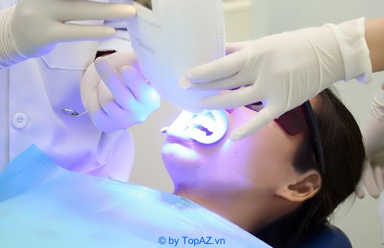 Các phương pháp tẩy trắng răng hà nội an toàn và hiệu quả nhất