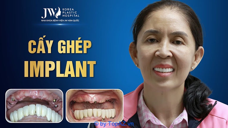 Trồng răng implant ở đâu tốt TPHCM webtretho 