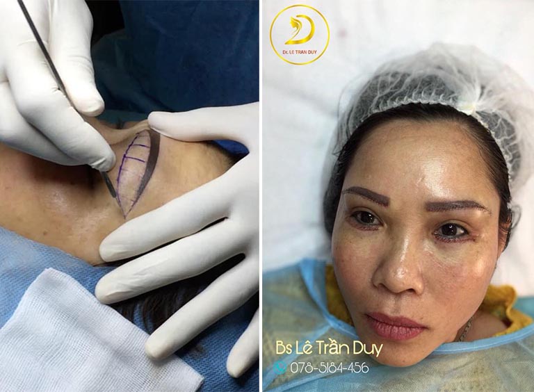 địa chỉ treo chân mày tphcm địa chỉ treo chân mày tphcm