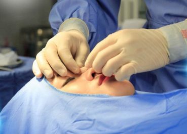Top 7 địa chỉ sửa mũi hỏng ở TPHCM uy tín, bác sĩ giỏi thực hiện