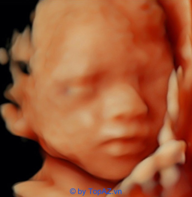Hình ảnh siêu âm 4D thai nhi tại phòng khám bác sĩ Kim Chi TP Biên Hoà Đồng Nai