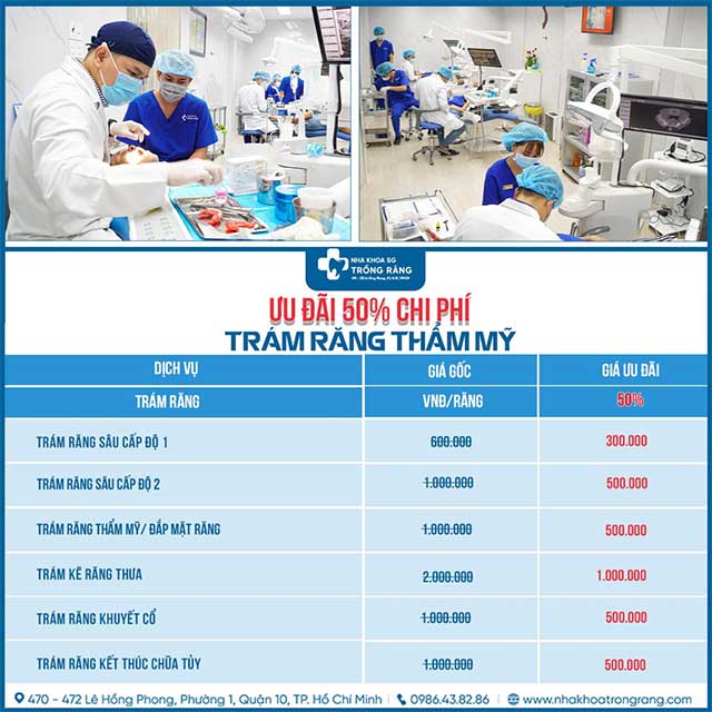 Bảng giá trám răng thẩm mỹ, nha khoa trồng răng Sài gòn 