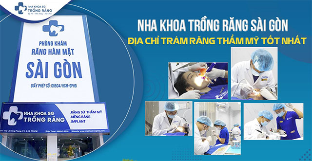 Bệnh viện Răng hàm mặt Sài Gòn có trám răng uy tín ở TPHCM không?
