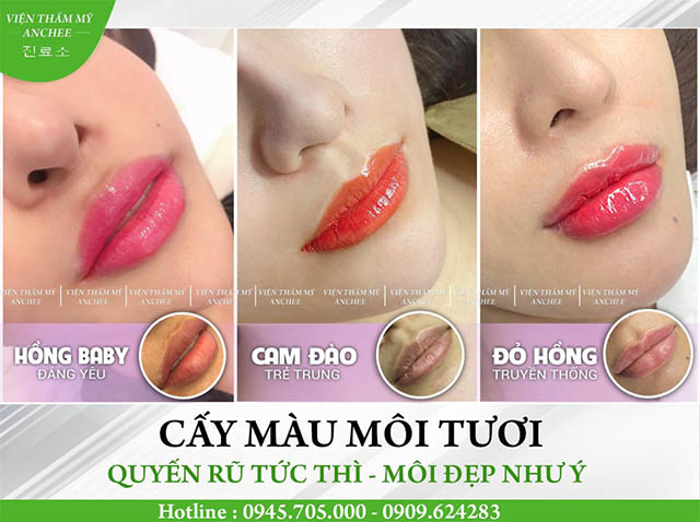 Khử thâm môi uy tín tại TPHCM, Anchee Clinic 