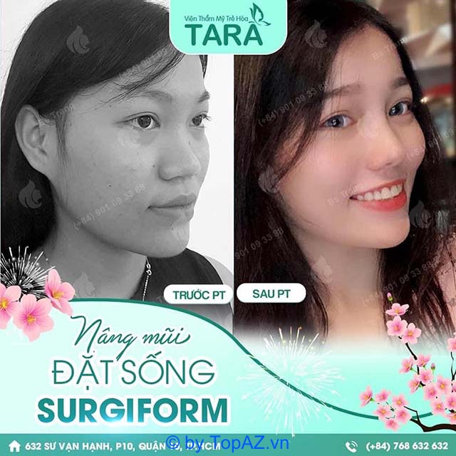 TARA Beauty Clinic nâng mũi đẹp
