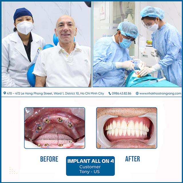 SaiGon Dental-Implant-District-10-ho-chi-minh