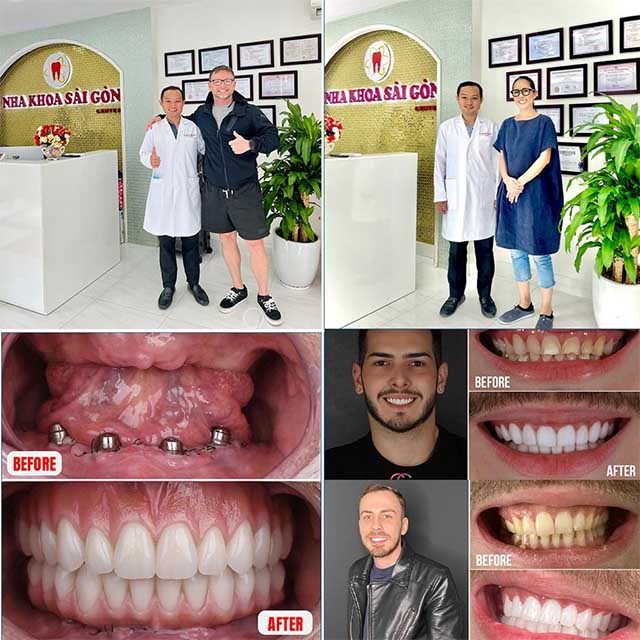 Bác sĩ nha khoa sài gòn nguyễn ngọc tân răng hàm mặt tphcm