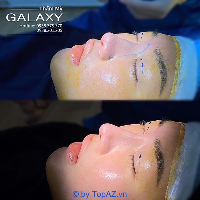 Thẩm mỹ Galaxy