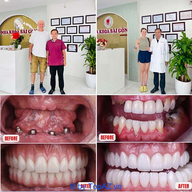 dental implant specialists in HCMC