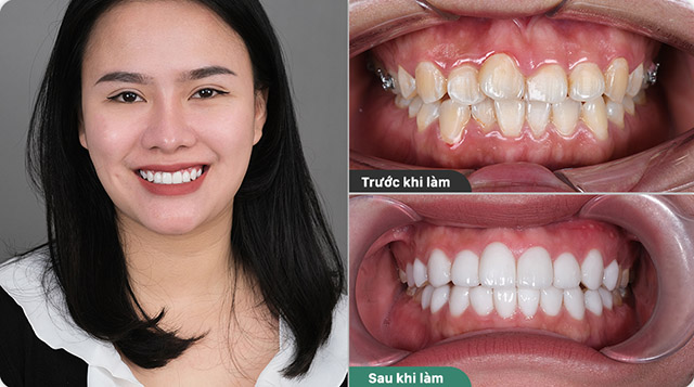 Phòng khám nha khoa tại TP. Cao Lãnh, Đồng Tháp