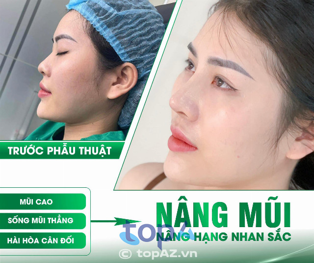 Phòng khám Chuyên khoa Phẫu thuật Thẩm mỹ Hường Xô Nghệ An