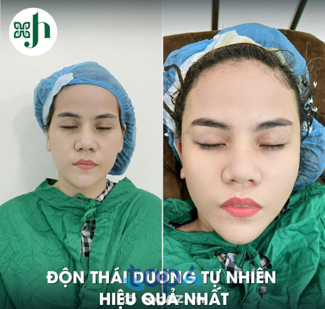 Thẩm mỹ viện Hường Xô Nghệ An