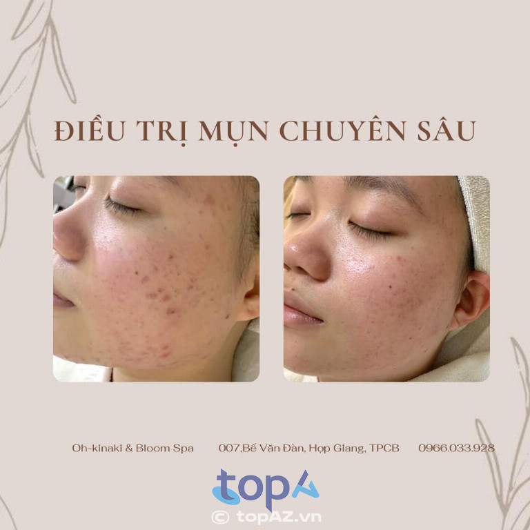 Oh-kinaki - Bloom Clinic & Spa tại TP. Cao Bằng