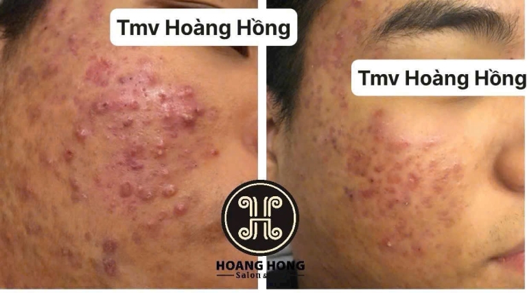 Thẩm mỹ viện Hoàng Hồng tại TP. Ninh Bình Thẩm mỹ viện Hoàng Hồng tại TP. Ninh Bình