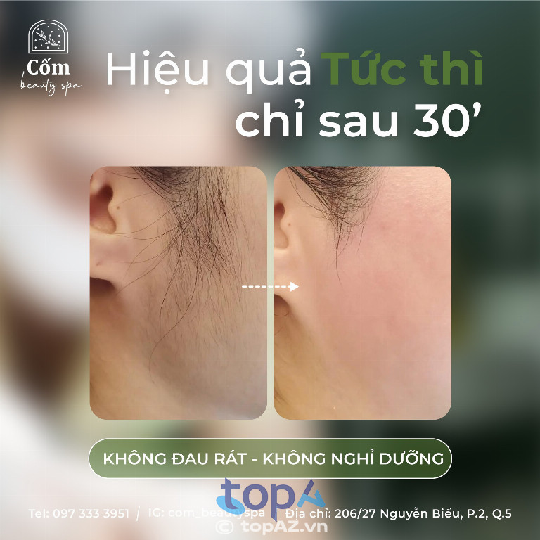 Cốm Beauty Spa