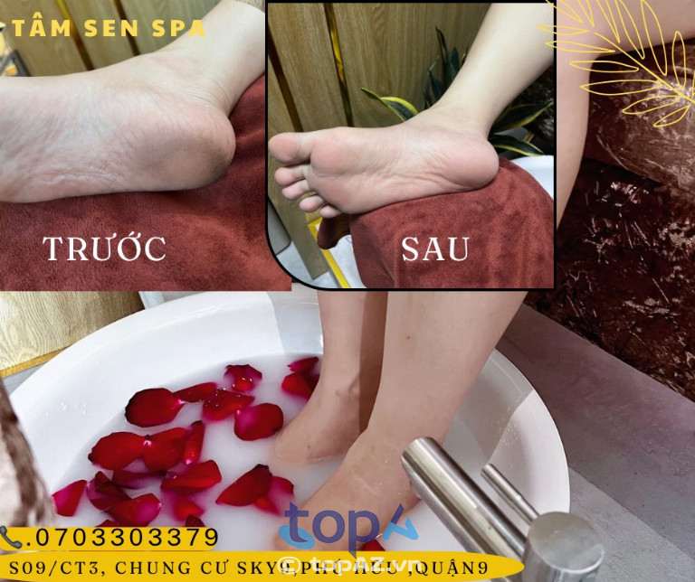 Spa chà gót chân Tâm Sen Spa tại Quận 9