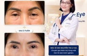 địa chỉ sửa mí mắt hỏng tại TPHCM