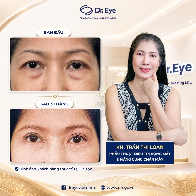 Phòng khám Chuyên khoa Thẩm mỹ Dr. Eye tại TPHCM Phòng khám Chuyên khoa Thẩm mỹ Dr. Eye tại TPHCM