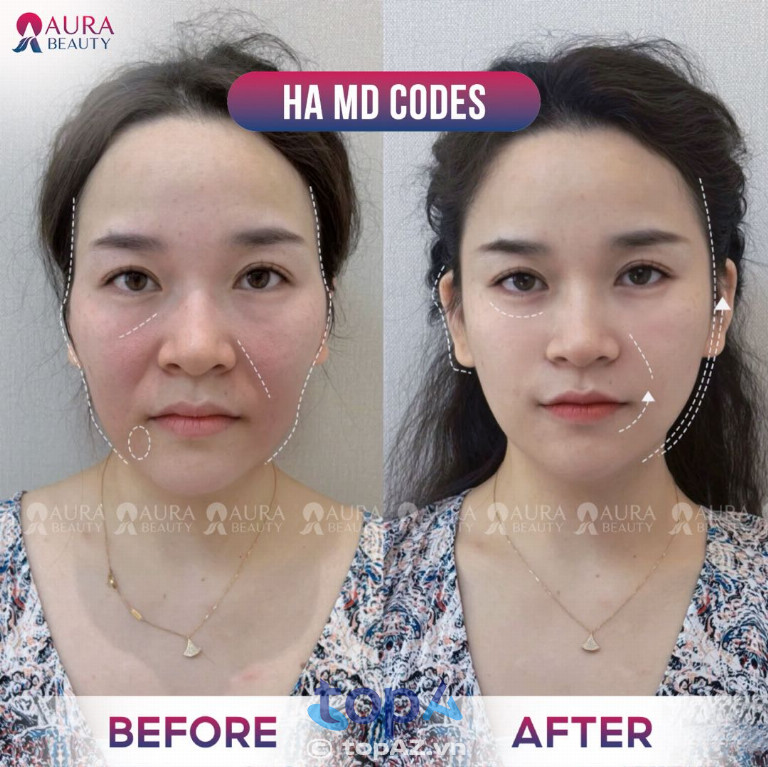 Thẩm mỹ viện Aur