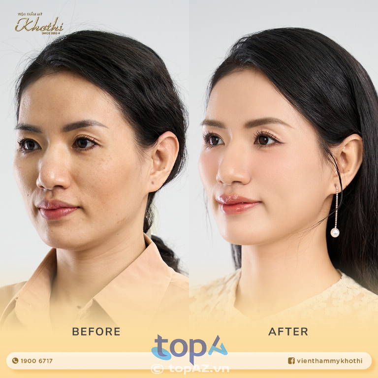 Viện Thẩm mỹ Khơ Thị