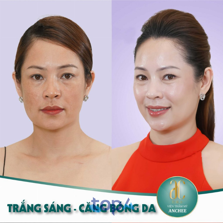 Viện thẩm mỹ Anchee Clinic
