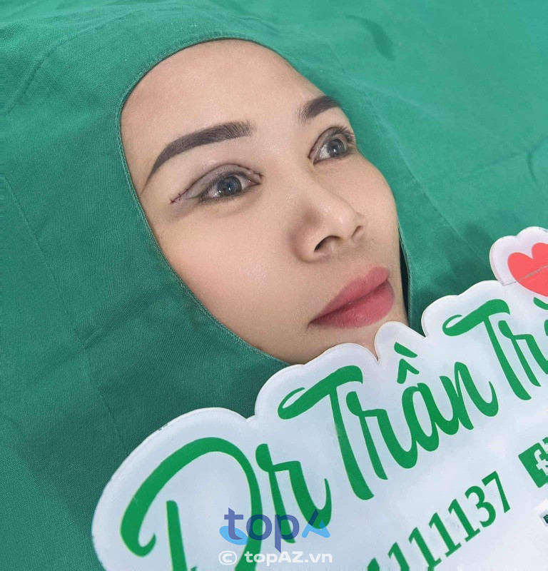 Dịch vụ thẩm mỹ mắt tại Thẩm Mỹ Viện Dr Trần Trà