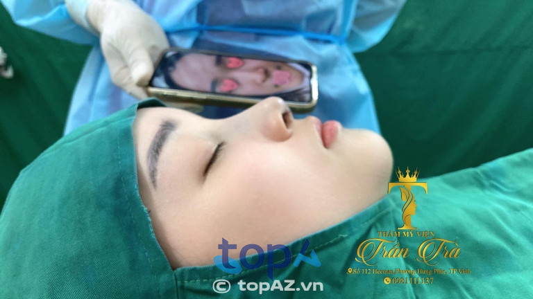 dịch vụ nâng mũi tại Thẩm Mỹ Viện Dr Trần Trà