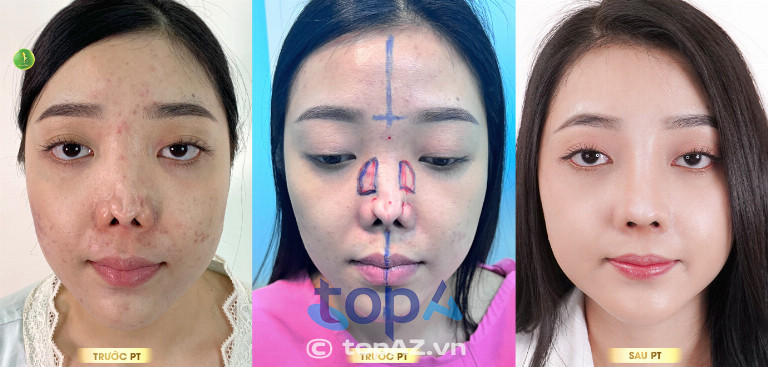 Bác sĩ Nguyễn Tiến Huy