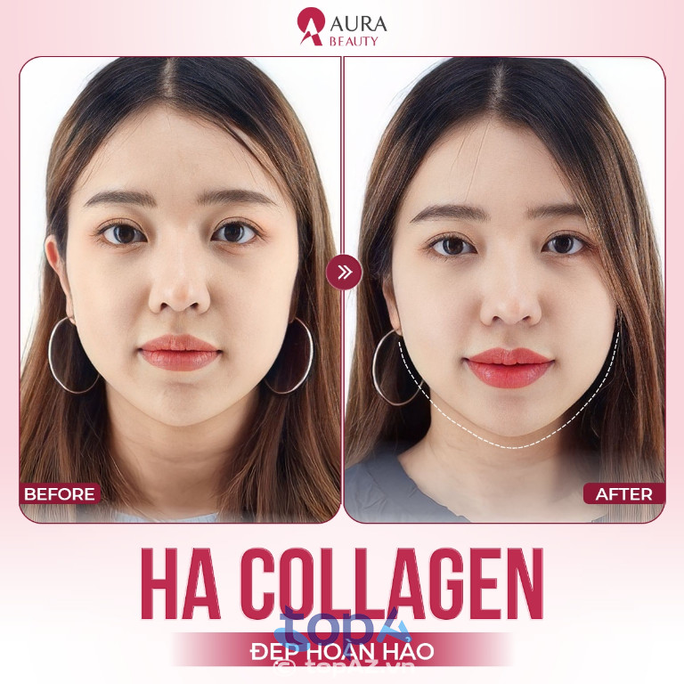 Thẩm mỹ viện quốc tế Aura