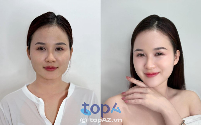 Thẩm Mỹ Viện Mailisa