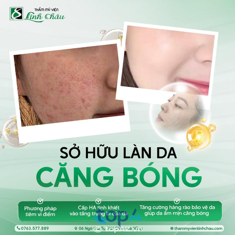 Thẩm mỹ viện Linh Châu