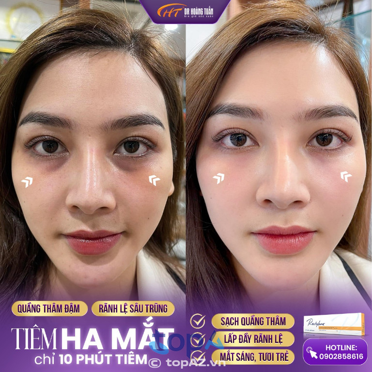 Thẩm mỹ Hoàng Tuấn