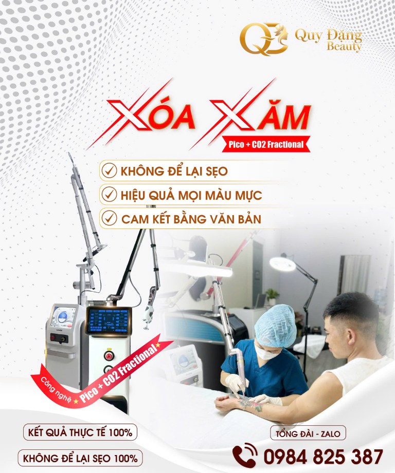 Xóa Hình Xăm tại Quy Đặng Beauty tại Hà Nội Xóa Hình Xăm tại Quy Đặng Beauty tại Hà Nội