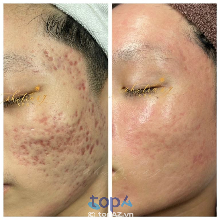 Khách hàng sau khi trải nghiệm luôn đánh giá cao sự tận tâm của Như Trang Spa Long Khánh