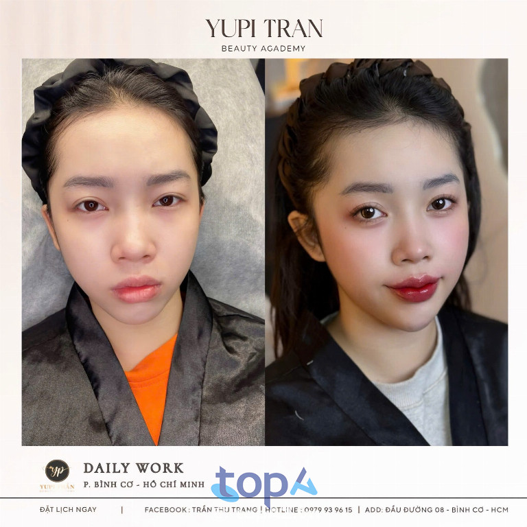 Thẩm Mỹ Viện Yupi Trần
