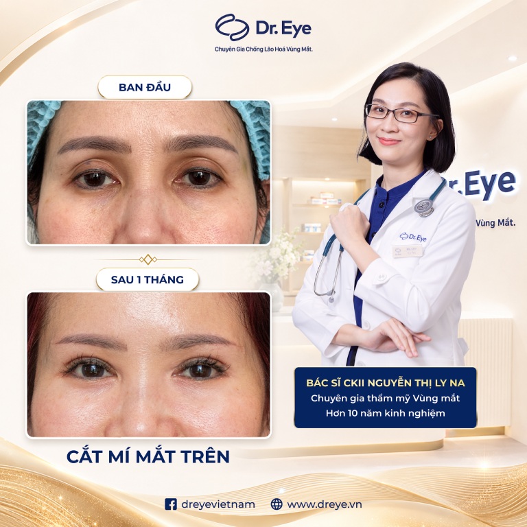 BS.CKII Nguyễn Thị Ly Na – Phòng khám Chuyên khoa Thẩm mỹ Dr. Eye tại TPHCM BS.CKII Nguyễn Thị Ly Na – Phòng khám Chuyên khoa Thẩm mỹ Dr. Eye tại TPHCM