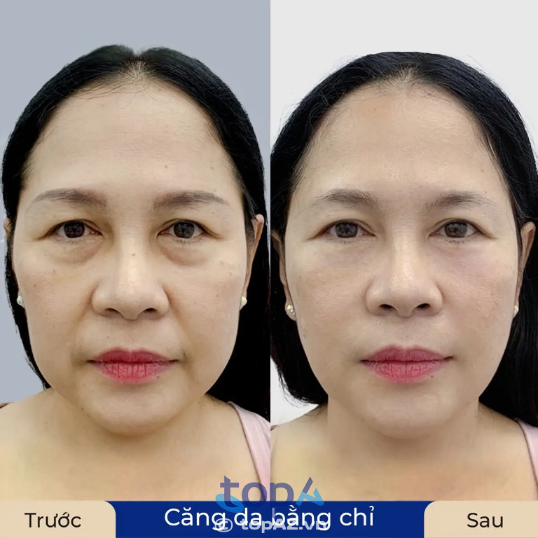 Bệnh viện Thẩm mỹ Kangnam