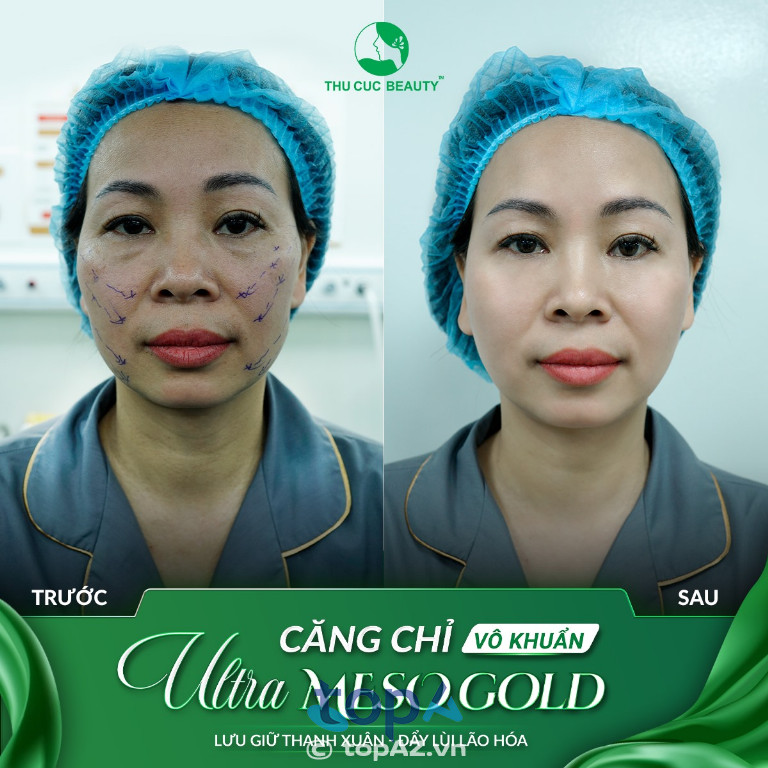 Bệnh viện Thẩm mỹ Thu Cúc