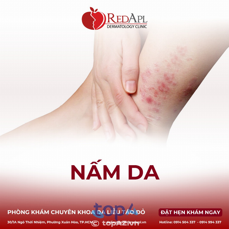 Phòng khám Da liễu Táo Đỏ