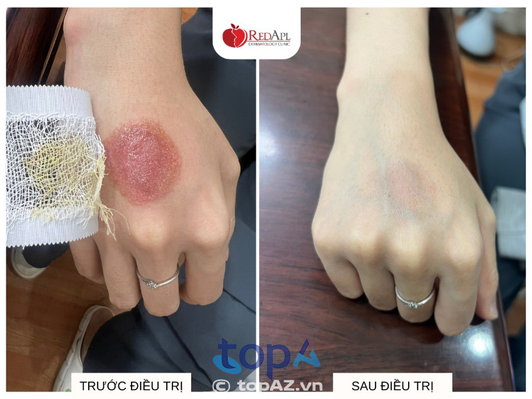 Phòng khám Da liễu Táo Đỏ