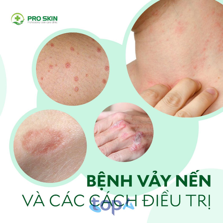 Phòng khám Da liễu Pro Skin