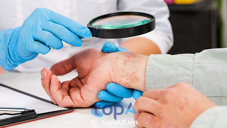 Cần chẩn đoán chính xác để có phác đồ điều trị thích hợp