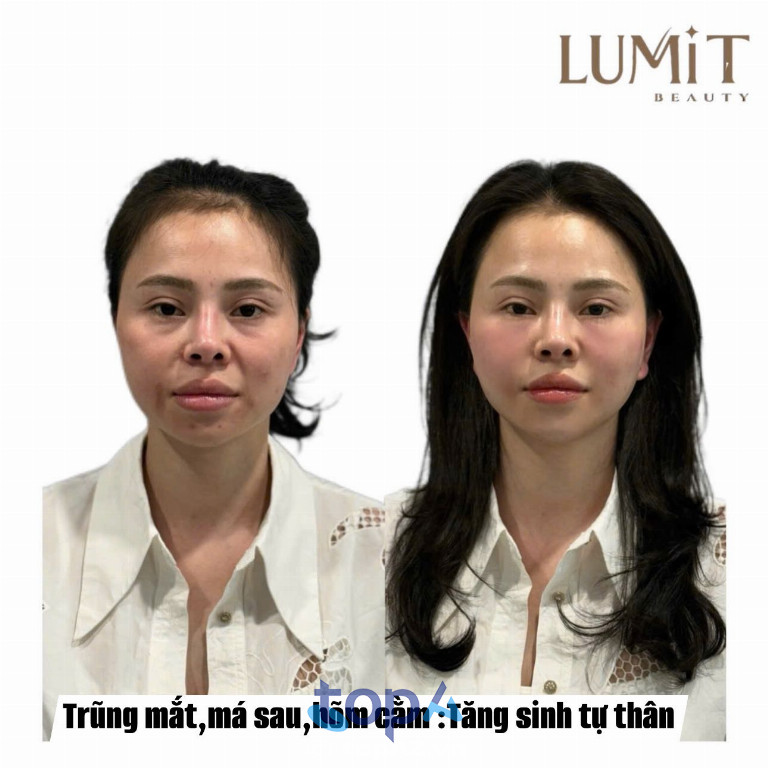 LUMI T Beauty