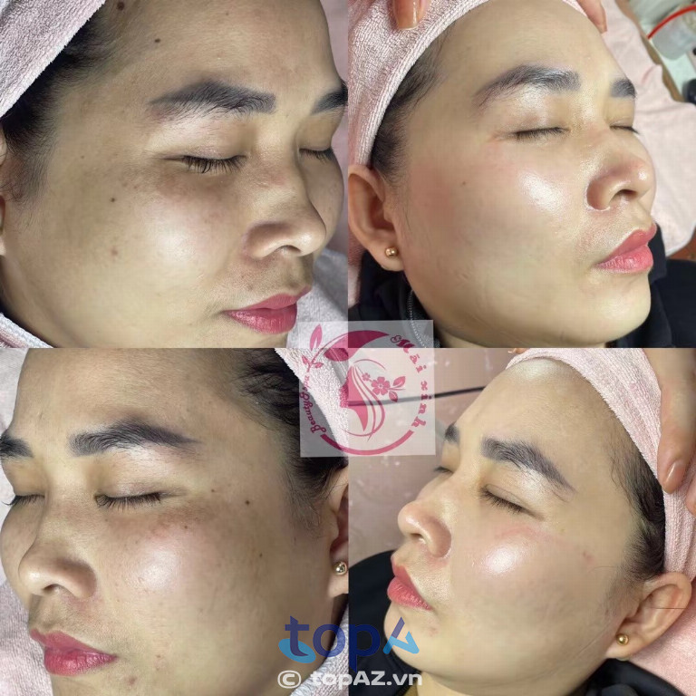 Mãi Xinh BeautySpa