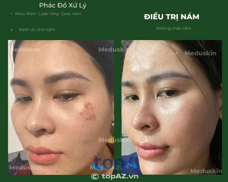 Thẩm Mỹ Thiên Hương