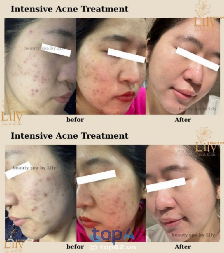 Tiệm DA Tại Nhà - Lily Beauty tại Hà Nội Tiệm DA Tại Nhà - Lily Beauty tại Hà Nội