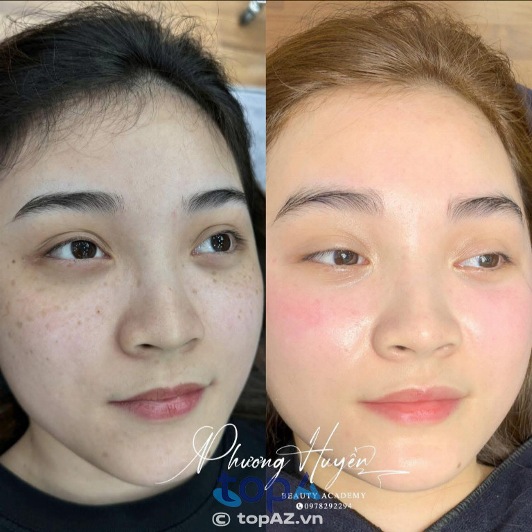 Thẩm Mỹ Phương Huyền